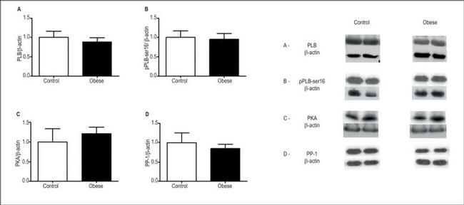 Phospholamban Antibody in Western Blot (WB)