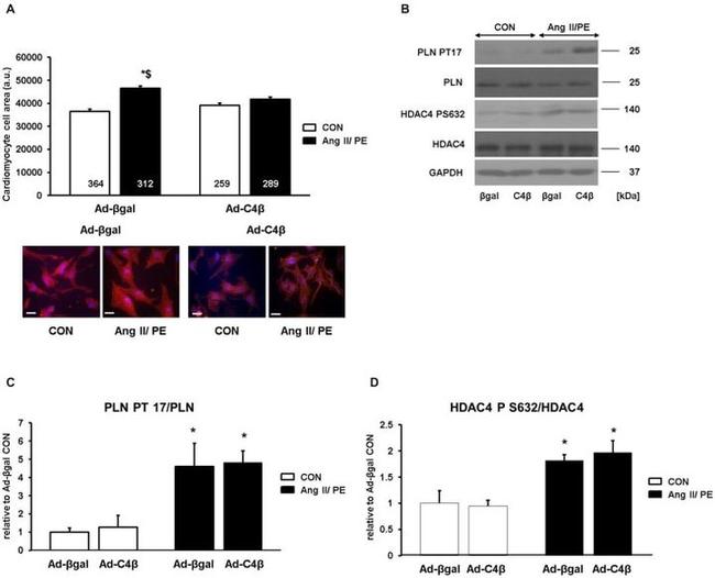 Phospholamban Antibody in Western Blot (WB)