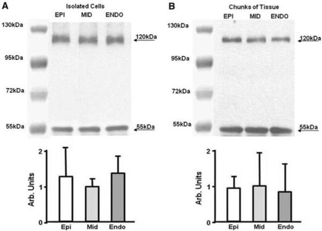 Sodium/Calcium Exchanger Antibody in Western Blot (WB)