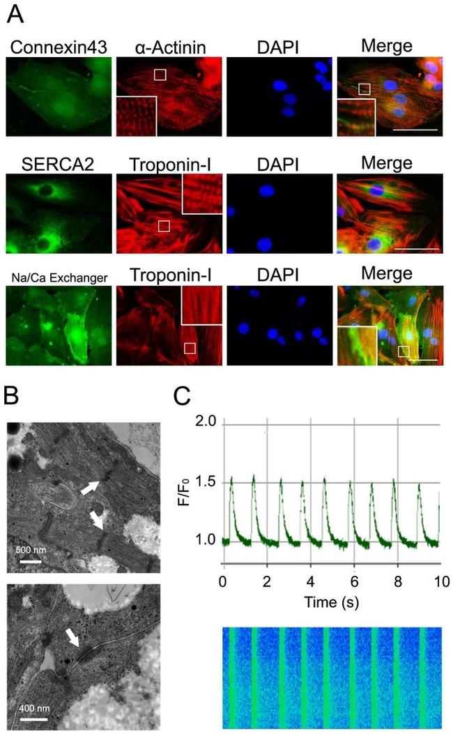 Sodium/Calcium Exchanger Antibody in Immunohistochemistry (IHC)