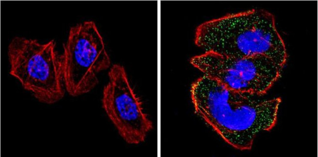 RASA1 Antibody in Immunocytochemistry (ICC/IF)