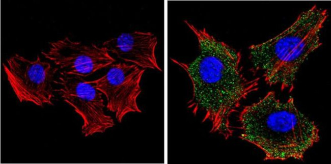 RASA1 Antibody in Immunocytochemistry (ICC/IF)