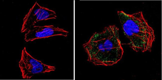 RASA1 Antibody in Immunocytochemistry (ICC/IF)