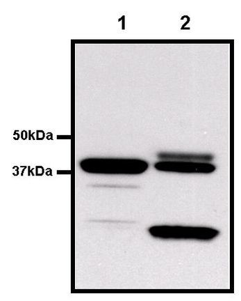 GST Tag Antibody in Immunoprecipitation (IP)