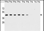 Vaccinia Virus H1L Antibody in Western Blot (WB)