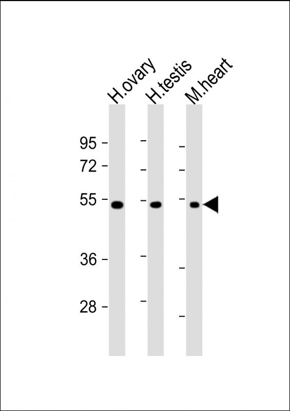 VEGFC Antibody in Western Blot (WB)