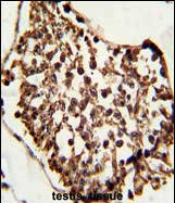 SETD8 Antibody in Immunohistochemistry (Paraffin) (IHC (P))