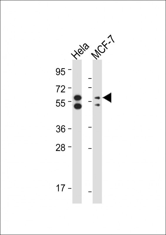 PINK1 Antibody in Western Blot (WB)