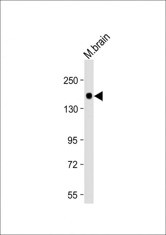 LRRK2 Antibody in Western Blot (WB)