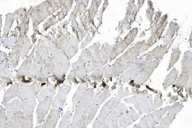 EphB2 Antibody in Immunohistochemistry (Paraffin) (IHC (P))