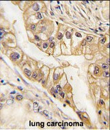 EphB2 Antibody in Immunohistochemistry (Paraffin) (IHC (P))