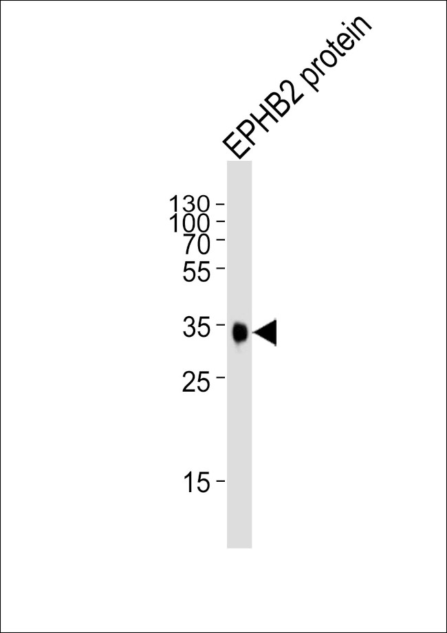 EphB2 Antibody in Western Blot (WB)