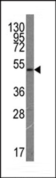 VEGF Receptor 3 Antibody in Western Blot (WB)