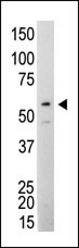 SRC Antibody in Western Blot (WB)