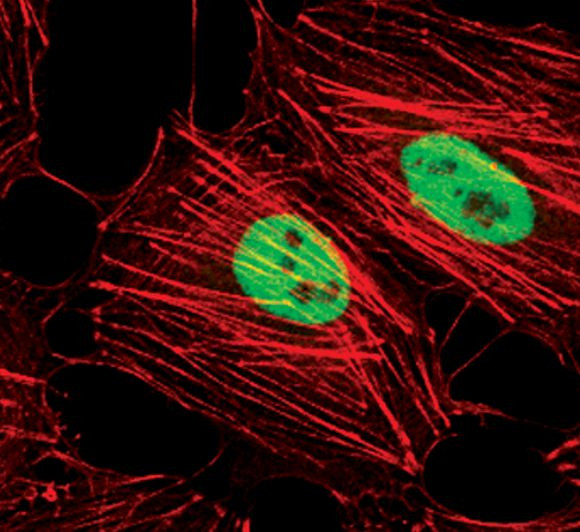 H3K4me3 Antibody in Immunocytochemistry (ICC/IF)