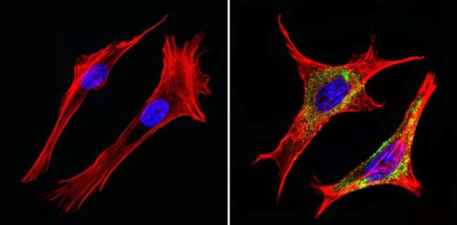 MUC1 Antibody in Immunocytochemistry (ICC/IF)