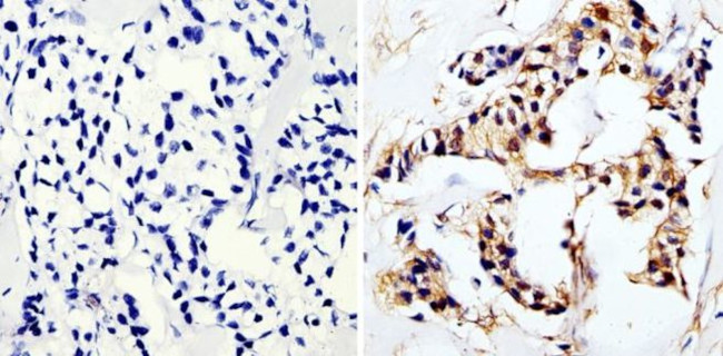 MUC1 Antibody in Immunohistochemistry (Paraffin) (IHC (P))