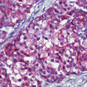 MUC1 Antibody in Immunohistochemistry (Paraffin) (IHC (P))