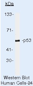 p53 Antibody in Western Blot (WB)