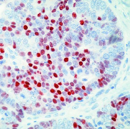 p57 Kip2 Antibody in Immunohistochemistry (Paraffin) (IHC (P))