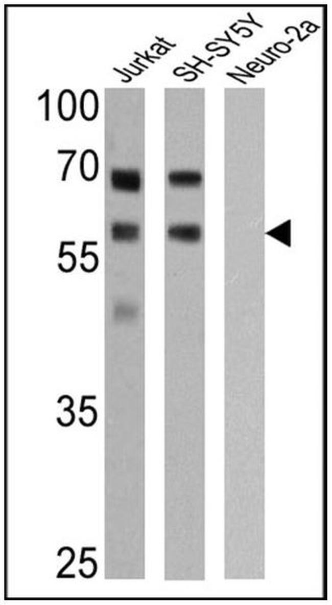 p57 Kip2 Antibody in Western Blot (WB)