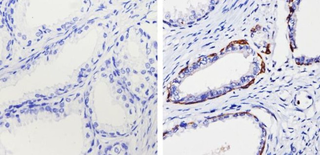 Cytokeratin 15 Antibody in Immunohistochemistry (Paraffin) (IHC (P))