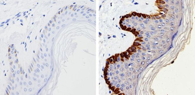 Cytokeratin 15 Antibody in Immunohistochemistry (Paraffin) (IHC (P))