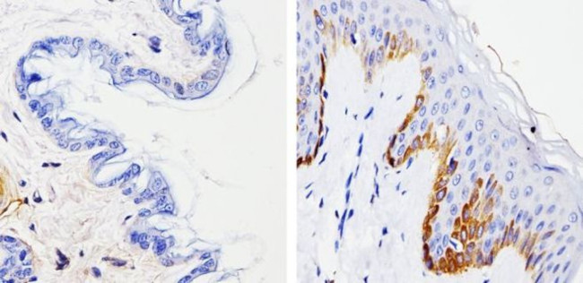 Cytokeratin 15 Antibody in Immunohistochemistry (Paraffin) (IHC (P))