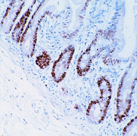 PCNA Antibody in Immunohistochemistry (Paraffin) (IHC (P))