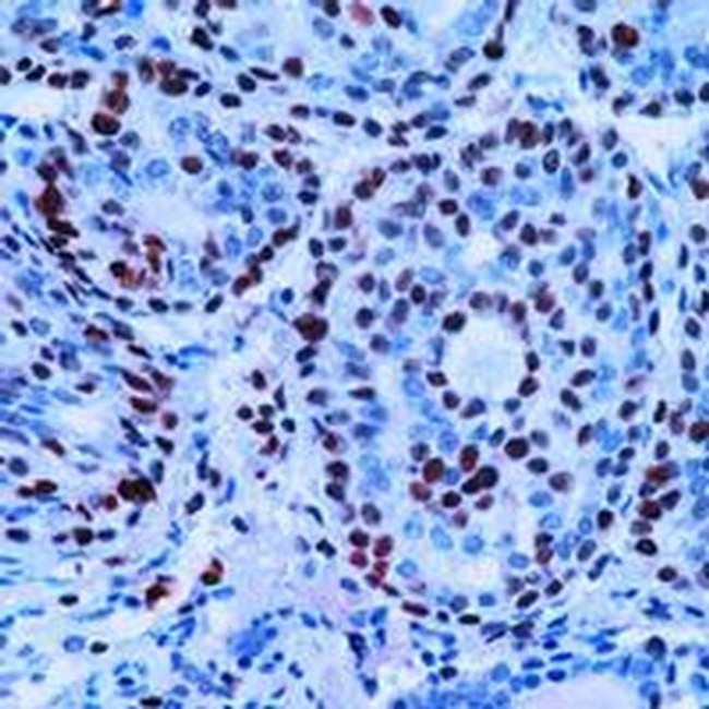 PCNA Antibody in Immunohistochemistry (Paraffin) (IHC (P))