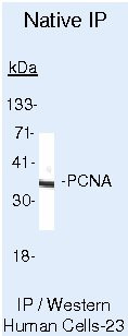 PCNA Antibody in Immunoprecipitation (IP)