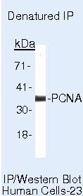 PCNA Antibody in Immunoprecipitation (IP)