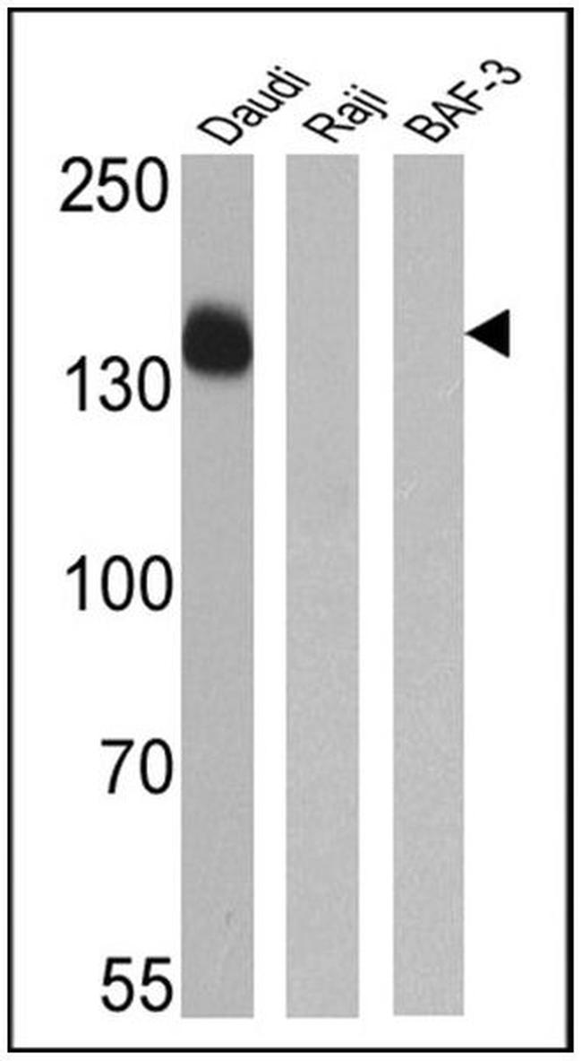 CD21 Antibody in Western Blot (WB)