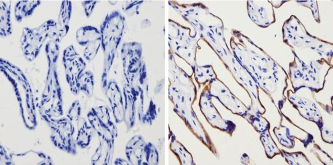 Transferrin Receptor Antibody in Immunohistochemistry (Paraffin) (IHC (P))