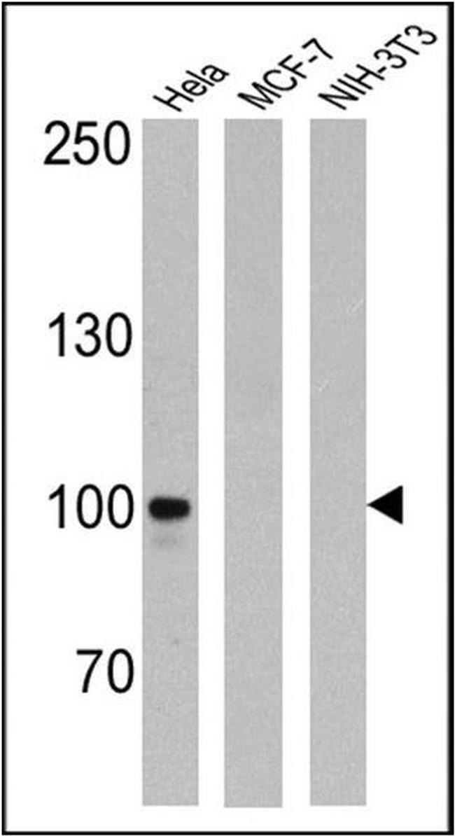 Transferrin Receptor Antibody in Western Blot (WB)