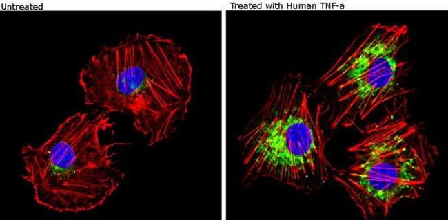 VCAM-1 Antibody