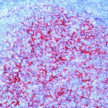 VCAM-1 Antibody in Immunohistochemistry (Paraffin) (IHC (P))