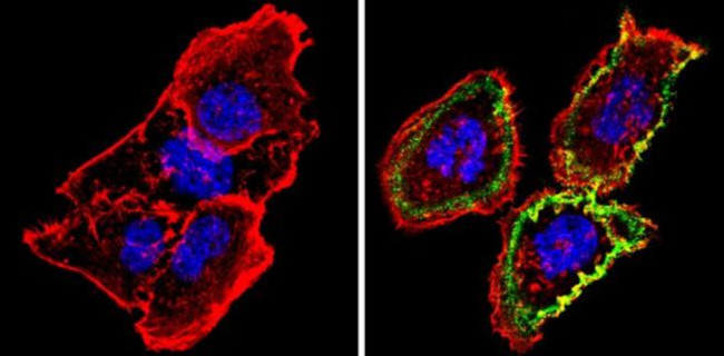 Thrombomodulin Antibody in Immunocytochemistry (ICC/IF)