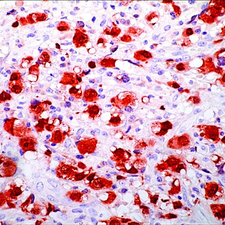 ALK Antibody in Immunohistochemistry (Paraffin) (IHC (P))