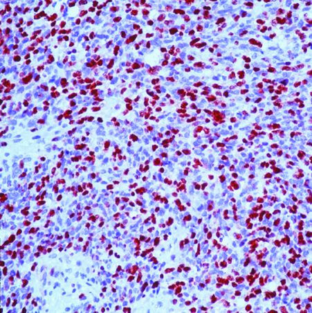 Myogenin Antibody in Immunohistochemistry (Paraffin) (IHC (P))