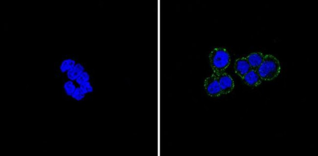 E-cadherin Antibody in Immunocytochemistry (ICC/IF)