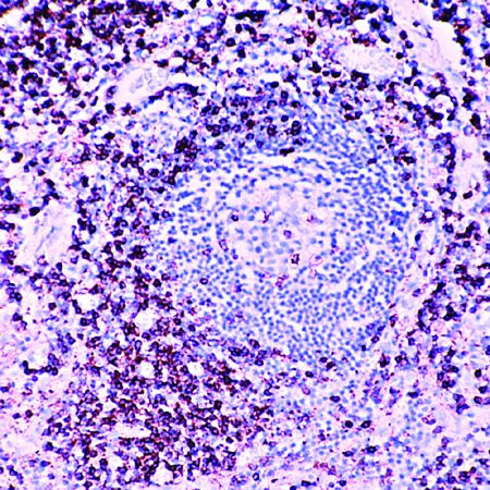 CD45RO Antibody in Immunohistochemistry (Paraffin) (IHC (P))