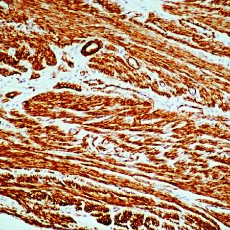 Alpha-Smooth Muscle Actin Antibody in Immunohistochemistry (Paraffin) (IHC (P))