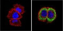 Alpha-Smooth Muscle Actin Antibody in Immunocytochemistry (ICC/IF)