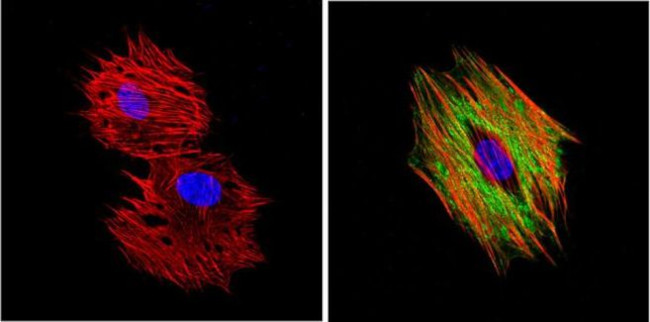 Alpha-Smooth Muscle Actin Antibody in Immunocytochemistry (ICC/IF)