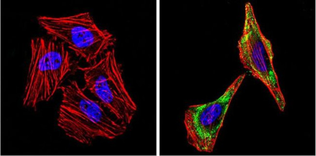 Alpha-Smooth Muscle Actin Antibody in Immunocytochemistry (ICC/IF)