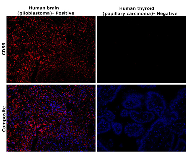 CD56 Antibody in Immunohistochemistry (Paraffin) (IHC (P))