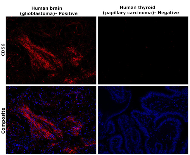 CD56 Antibody in Immunohistochemistry (Paraffin) (IHC (P))