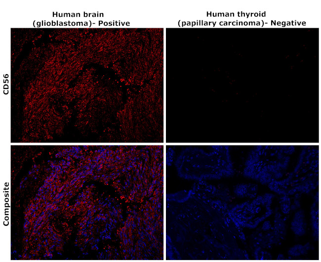 CD56 Antibody in Immunohistochemistry (Paraffin) (IHC (P))