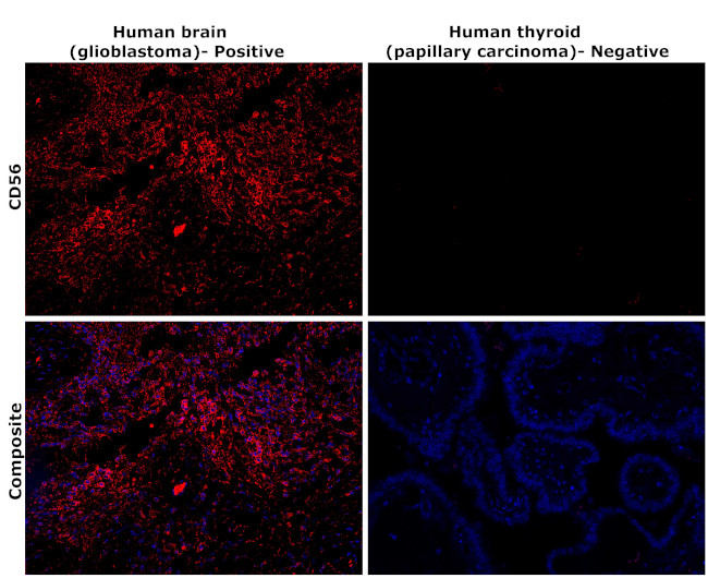 CD56 Antibody